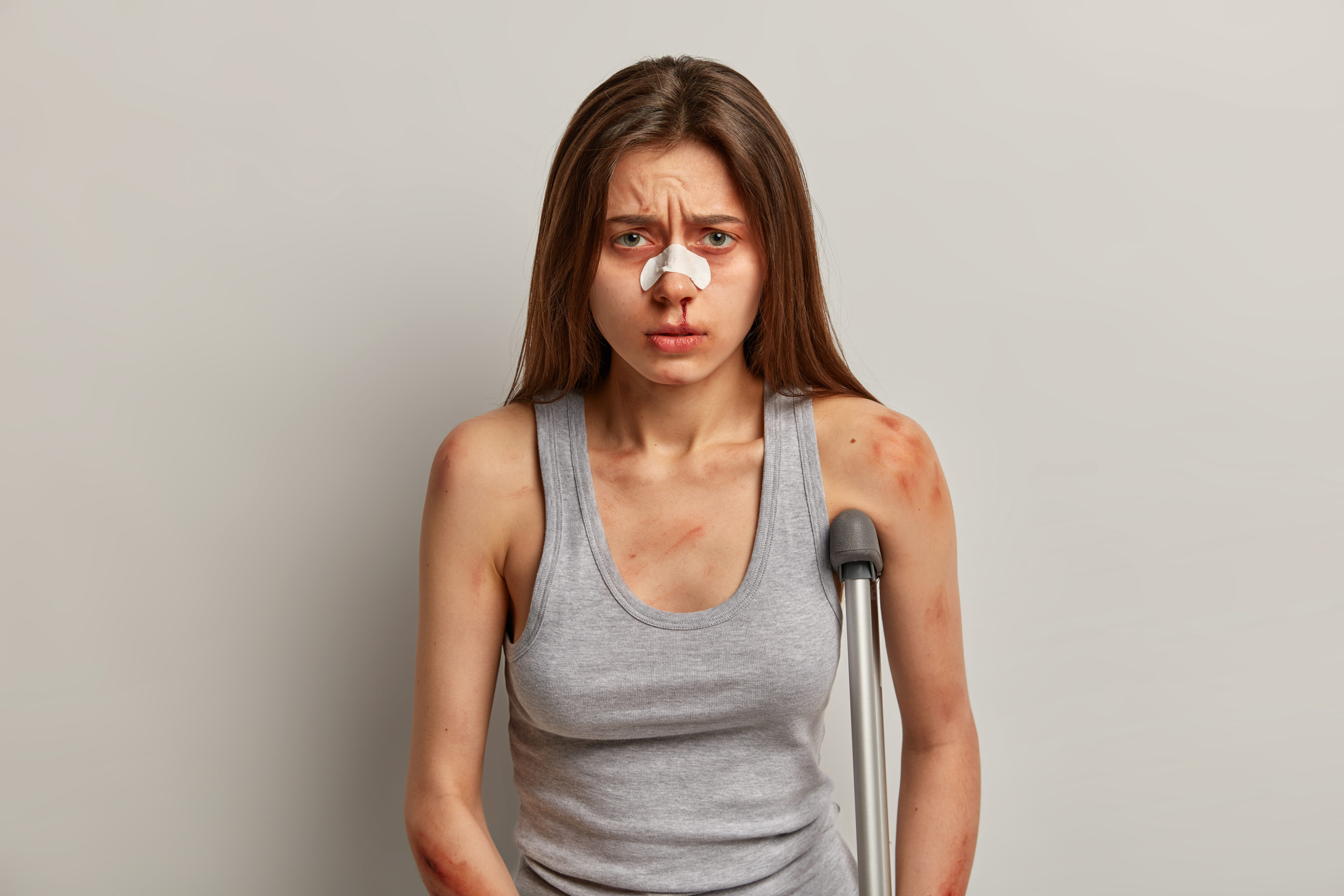 Injured woman with crutches and bandages against a plain background