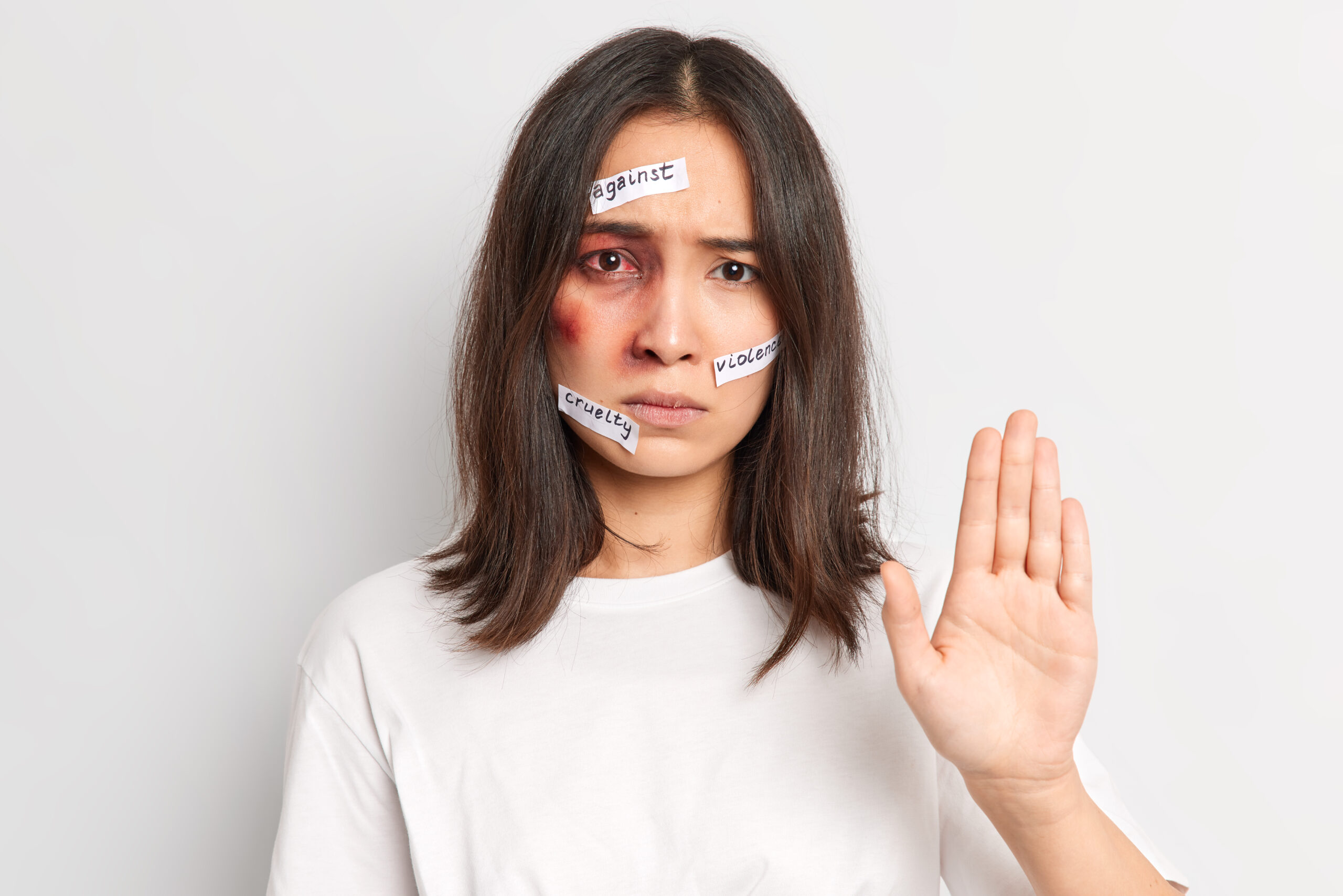 Woman with bruised eye showing stop gesture, text "against cruelty" on face